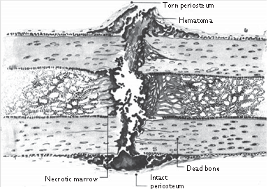 Illustration 5 for Pass Your Basic Sciences Viva: Key Anatomy & Pathology