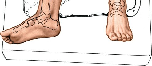Illustration 15 for Optimized Approaches to the Dorsum of the Foot & Ankle