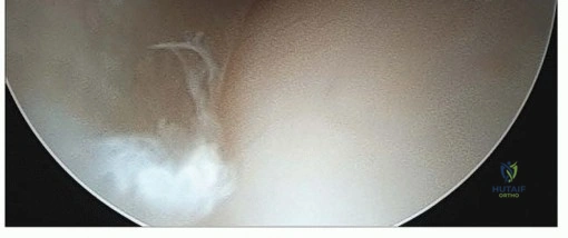 صورة توضيحية لـ دليل الأستاذ الدكتور محمد هطيف الشامل لصحة العظام والمفاصل: فهم التشريح، الأمراض، وخيارات العلاج المتقدمة في صنعاء