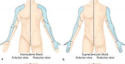 Optimizing Perioperative Pain Management in Shoulder Surgery: An Academic Review