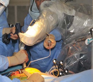 Illustration 30 for Robotics in Total Hip Arthroplasty: A New Era of Precision