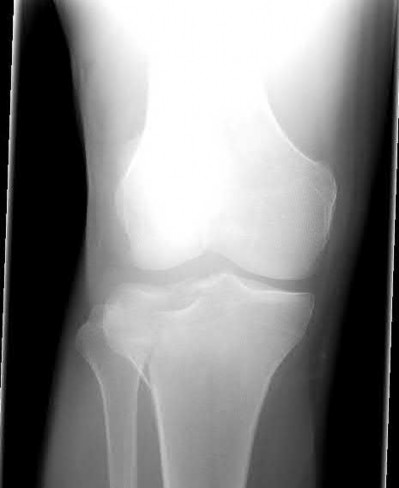 Illustration 115 for OrthoCash: Trauma MCQs & Cases for a yearold woman