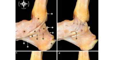 Illustration 101 for OrthoCash: Trauma MCQs & Cases for a yearold woman