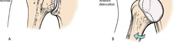 Illustration 40 for Enhance Anterior Shoulder Surgery: Crucial Joint Applied Surgical Anatomy