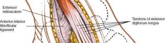 Illustration 92 for Optimized Approaches to the Dorsum of the Foot & Ankle