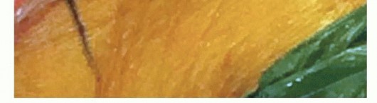 Illustration 41 for Achieve Lasting Pain Relief with Cemented Total Knee Arthroplasty