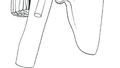 Illustration 20 for Deepen Skills: Anterolateral & Lateral Surgical Approaches