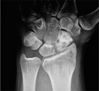 Illustration 3 for Unlock Wrist Diagnosis: Cases Guided by Figure Sunil Thirkannad