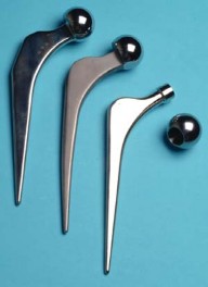 Illustration 4 for Looking for the Ideal Hip Implant? Uncover Key Factors