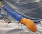 Posterior Shoulder Instability: Arthroscopic Shoulder J Bone Joint Solutions