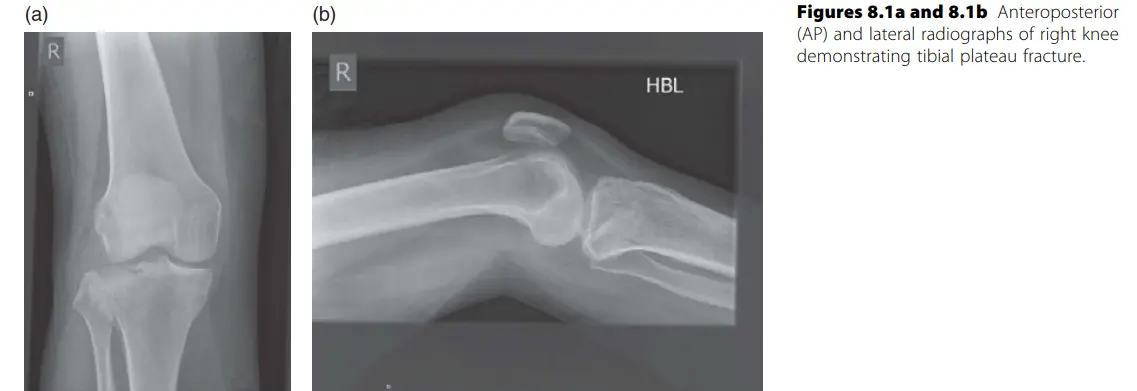 إصابات الطرف السفلي: دليلك الشامل للتشخيص والعلاج والتعافي مع الأستاذ الدكتور محمد هطيف في صنعاء