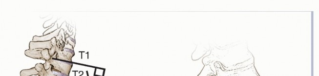 Illustration 14 for Adult Scoliosis: Uncover Causes & Find Lasting Back Pain Relief