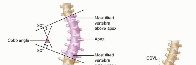 Mastering Posterior Exposure of the Thoracic & Lumbar Spine