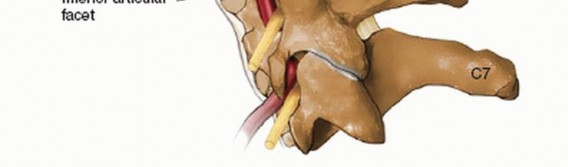 Illustration 26 for Master Techniques for Cervical Fracture Reduction: Type III & More