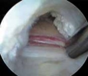 Illustration 15 for J. W. Thomas on Snapping Hip: Causes, Cures & Relief