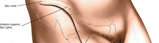 Illustration 10 for Unlocking Every Aspect of the Hip's Surgical Approaches