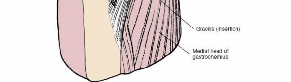 Illustration 94 for Mastering Knee Approaches: Spotlight on Superficial Medial Ligament
