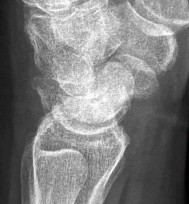 صورة طبية: دليل الأستاذ الدكتور محمد هطيف الشامل لأمراض وإصابات اليد والمعصم في صنعاء