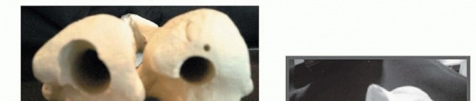 Illustration 20 for Achieve Optimal Femoral Head Fixation with Cephalomedullary Nailing