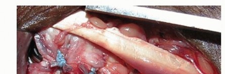 Illustration 15 for Distal Radius Fixation: Precision Through Lister's Tubercle