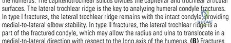 Distal Humerus Fractures: Understanding Causes, Anatomy & Epidemiology