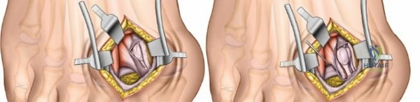 Clinical Image
