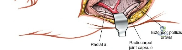 Clinical Image