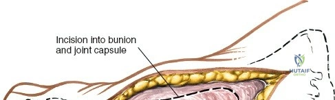Clinical Image