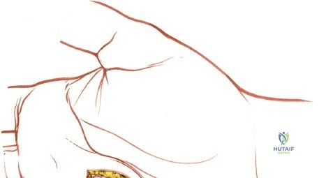 Illustration of medial midpalmar space - Dr. Mohammed Hutaif