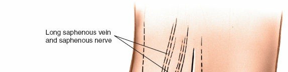 Step-by-Step Medial Side of the Ankle Approach Guide