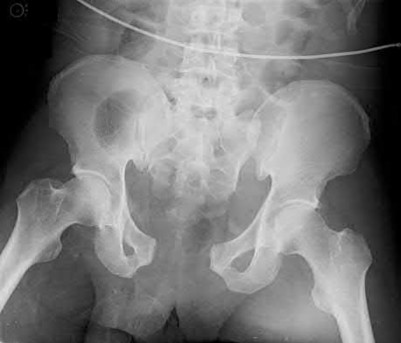 Illustration 182 for OrthoCash: Trauma MCQs & Cases for a yearold woman