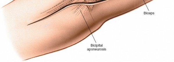 Illustration 73 for Mastering Elbow Approaches: Applied Surgical Anatomy for Precision