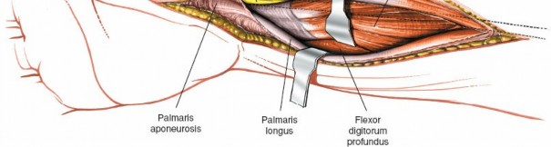 Illustration 79 for Essential Surgical Approaches: Uncover Every Aspect of the Wrist