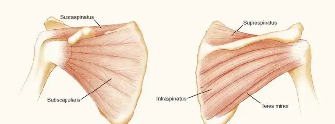 صورة توضيحية لـ وداعًا لخلع الكتف المتكرر: دليل شامل لعمليات إصلاح بانكارت وتثبيت المحفظة السفلية مع الأستاذ الدكتور محمد هطيف