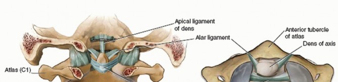 Illustration 5 for Master Techniques for Cervical Fracture Reduction: Type III & More