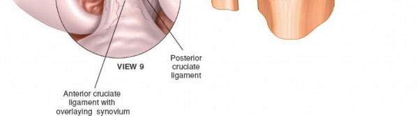 Illustration 24 for Mastering Knee Approaches: Spotlight on Superficial Medial Ligament