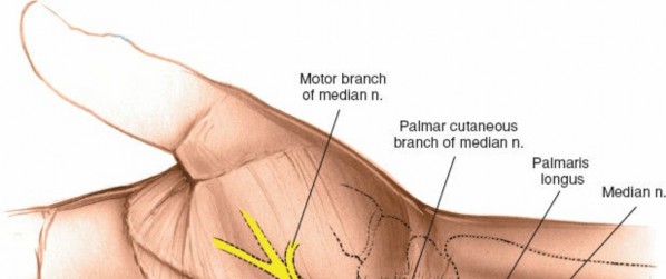 Illustration 12 for Volar Approach: Optimal Exposure for the Volar aspect of the Distal Radius