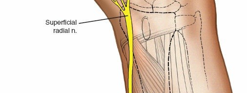 Illustration 11 for Key Approaches for External Fixation: Humerus, Radius, Ulna, Wrist