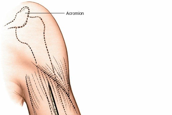 Illustration 33 for Mastering the Approach to the Distal Humerus: Safety & Skills