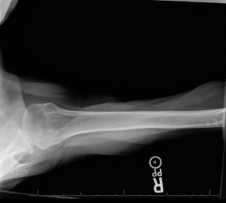 Illustration 23 for Right Shoulder Pain? Avoid This Common X-ray Mistake.