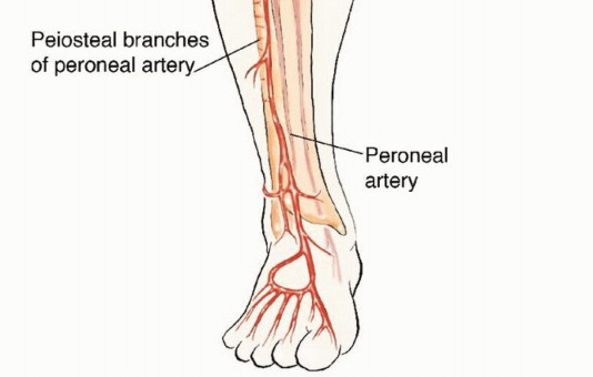 Illustration 2 for Free Vascularized Fibular Grafts: Solving Complex Bone Defects