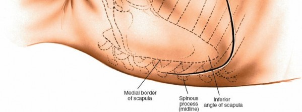 Illustration 309 for Approach to the Lumbar Spine: Mastering Techniques & Anatomy