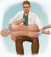 Illustration 4 for Optimizing Instrumentation for Neuromuscular Scoliosis