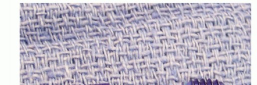 Illustration 8 for Hammer Toe Correction: Understanding the Extensor Digitorum Longus