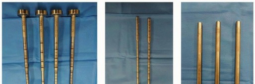 Illustration 15 for Cement in Cement Revision: Simplifying Complex Hip Revisions