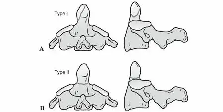 كسور النتوء السني (النتوء السني للعظم المحوري): دليل شامل للمريض في اليمن والخليج مع الأستاذ الدكتور محمد هطيف