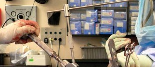 Illustration 32 for Exploring the Ambulatory Surgical Setting for Total Hip Replacement