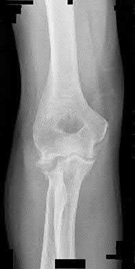 Illustration 77 for OrthoCash: Trauma MCQs & Cases for a yearold woman