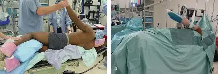 صورة توضيحية لـ جراحة منظار الكتف: دليلك الشامل لراحة دائمة وكتف قوي مع الأستاذ الدكتور محمد هطيف