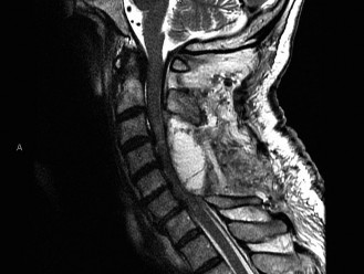 Illustration 46 for Master Orthopedic Spine Cases: Sharpen Your Diagnostic Skills